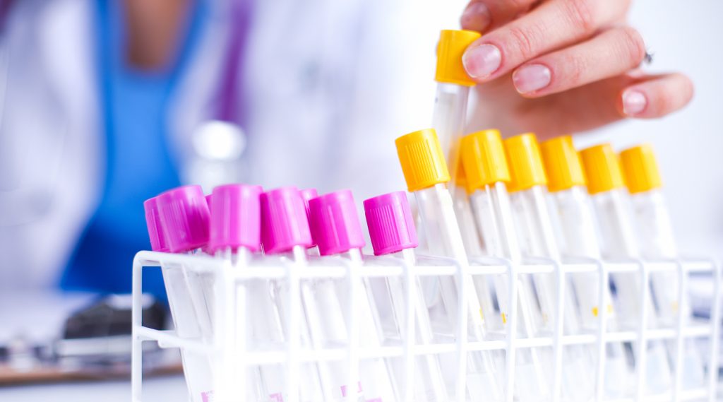 labeling thousands of pipettes and ampoules